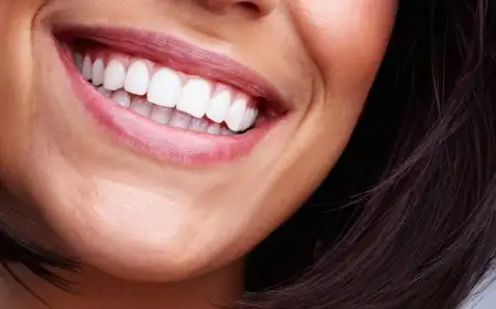 تنظيف وتبييض الأسنان تنظيف وتبييض الأسنان