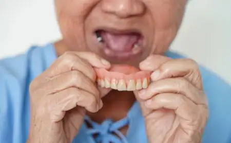 تركيبات الأسنان تركيبات الأسنان